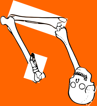 Dem bones dem bones dem – dry bones!