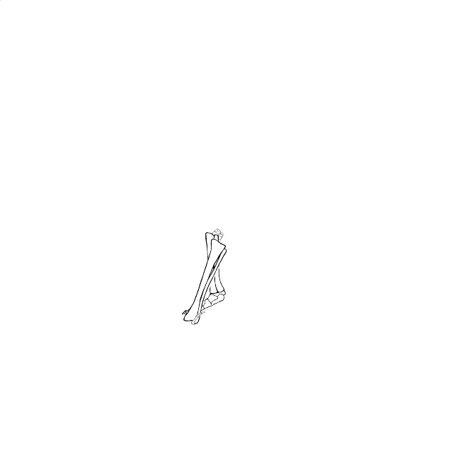 Dem bones dem bones dem – dry bones!