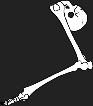 Dem bones dem bones dem – dry bones!
