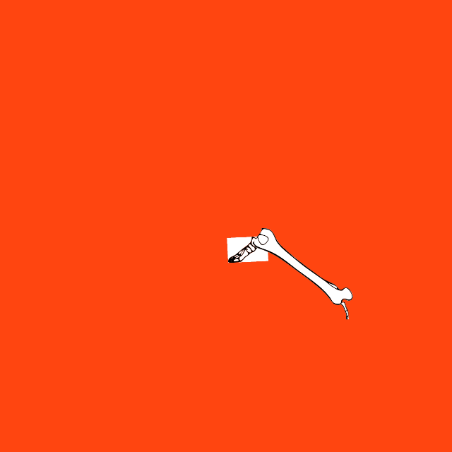 Dem bones dem bones dem – dry bones!