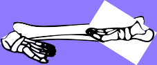 Dem bones dem bones dem – dry bones!