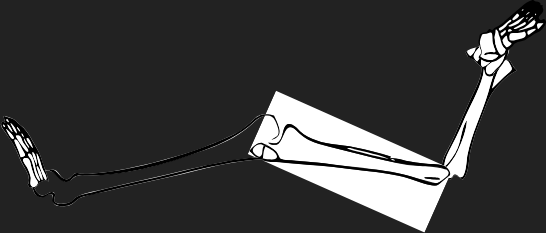 Dem bones dem bones dem – dry bones!