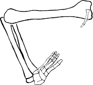 Dem bones dem bones dem – dry bones!
