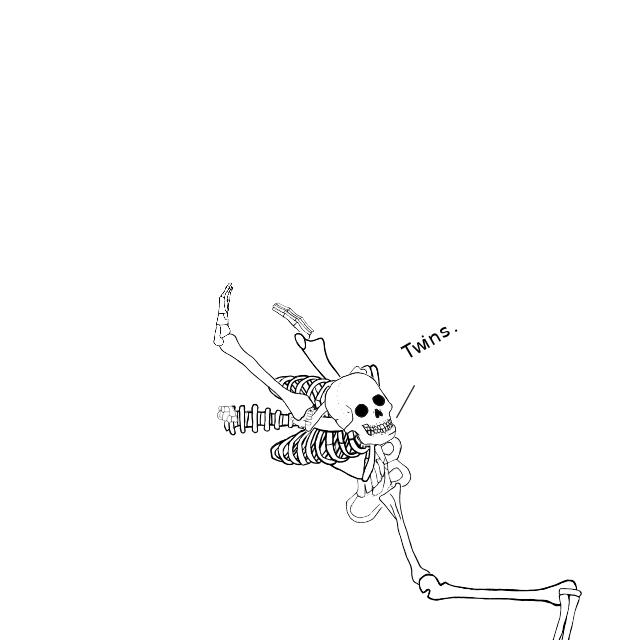 Dem bones dem bones dem – dry bones!