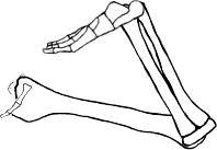 Dem bones dem bones dem – dry bones!