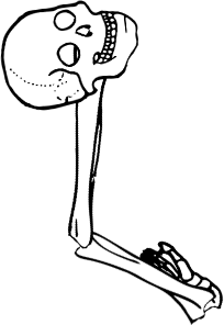 Dem bones dem bones dem – dry bones! Dem bones dem bones dem – extra bones!