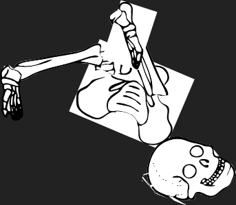 Dem bones dem bones dem – dry bones!