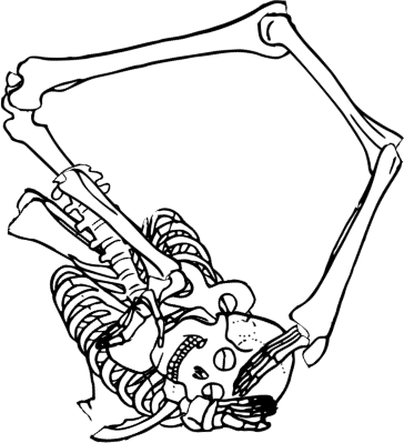 Dem bones dem bones dem – dry bones!