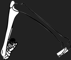 Dem bones dem bones dem – dry bones!  | Dem bones dem bones dem – extra bones!