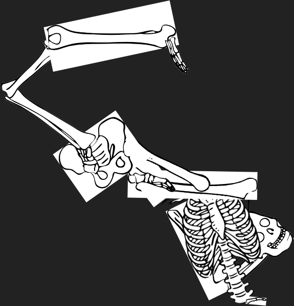 Dem bones dem bones dem – dry bones!