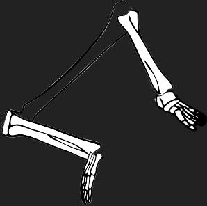 Dem bones dem bones dem – dry bones!  | Dem bones dem bones dem – extra bones!