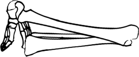 Dem bones dem bones dem – dry bones!