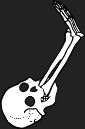 Dem bones dem bones dem – dry bones!