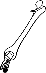 Dem bones dem bones dem – dry bones!