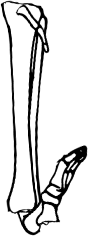 Dem bones dem bones dem – dry bones!