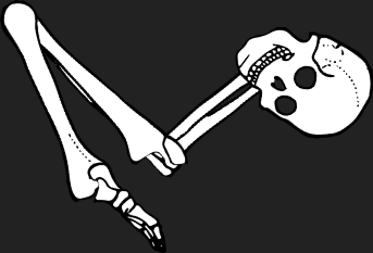 Dem bones dem bones dem – dry bones!