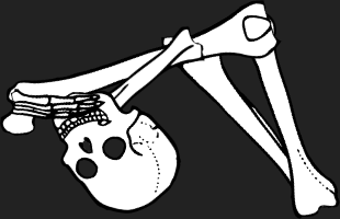 Dem bones dem bones dem – dry bones!