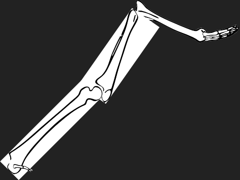 Dem bones dem bones dem – dry bones!