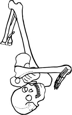Dem bones dem bones dem – dry bones!