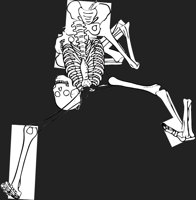 Dem bones dem bones dem – dry bones!  | Dem bones dem bones dem – extra bones!