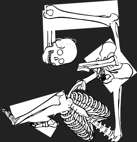 Dem bones dem bones dem – dry bones!