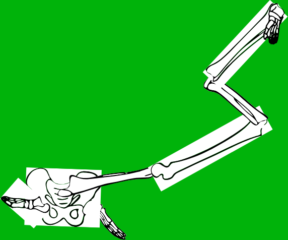 Dem bones dem bones dem – dry bones!
