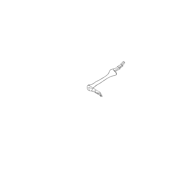 Dem bones dem bones dem – dry bones!