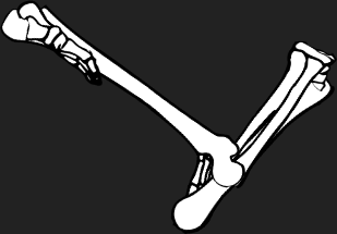 Dem bones dem bones dem – dry bones! Dem bones dem bones dem – extra bones!