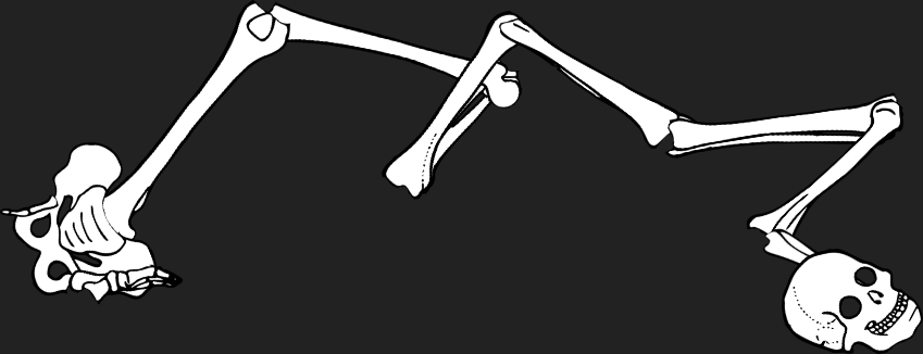 Dem bones dem bones dem – dry bones!