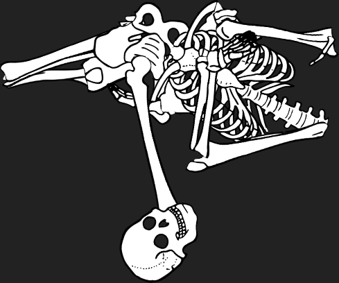 Dem bones dem bones dem – dry bones!