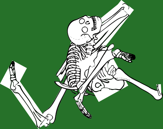 Dem bones dem bones dem – dry bones!