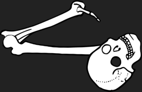 Dem bones dem bones dem – dry bones!