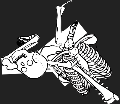 Dem bones dem bones dem – dry bones!