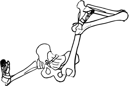 Dem bones dem bones dem – dry bones!