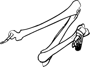 Dem bones dem bones dem – dry bones!