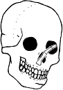 Dem bones dem bones dem – dry bones!