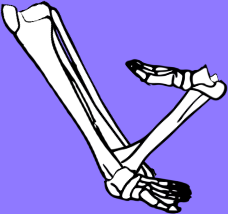 Dem bones dem bones dem – dry bones! Dem bones dem bones dem – extra bones!