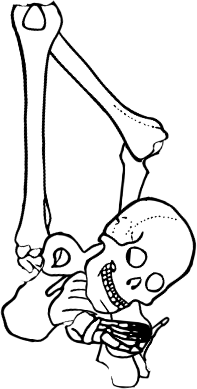 Dem bones dem bones dem – dry bones!