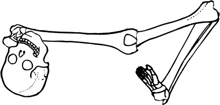 Dem bones dem bones dem – dry bones!
