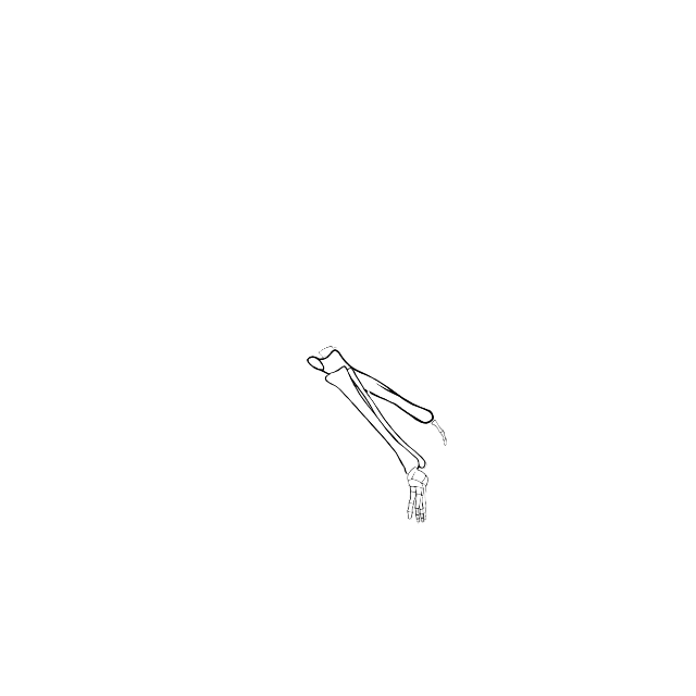 Dem bones dem bones dem – dry bones!
