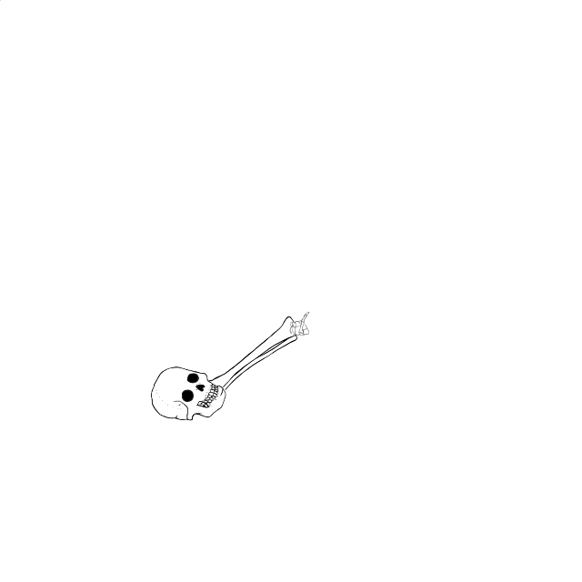 Dem bones dem bones dem – dry bones!