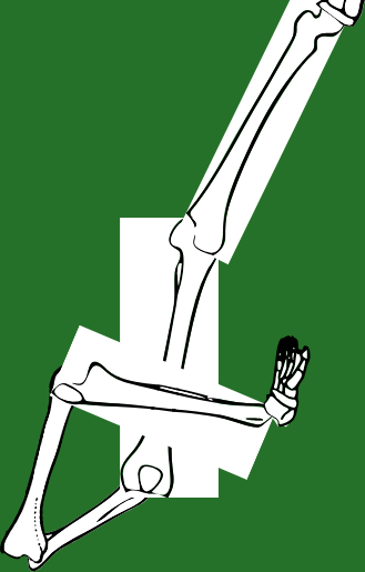 Dem bones dem bones dem – dry bones!
