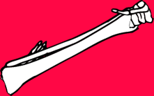 Dem bones dem bones dem – dry bones!
