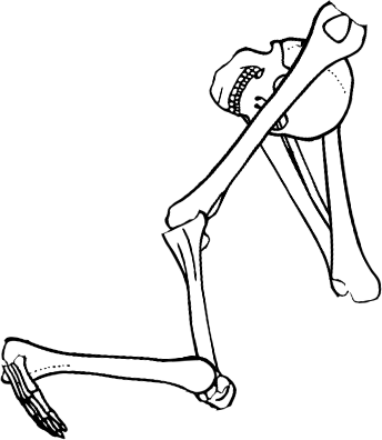 Dem bones dem bones dem – dry bones!