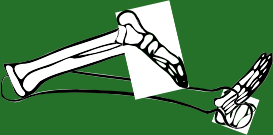 Dem bones dem bones dem – dry bones!