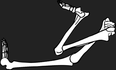 Dem bones dem bones dem – dry bones!