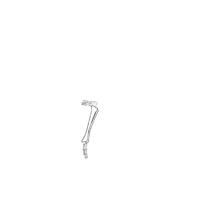 Dem bones dem bones dem – dry bones!