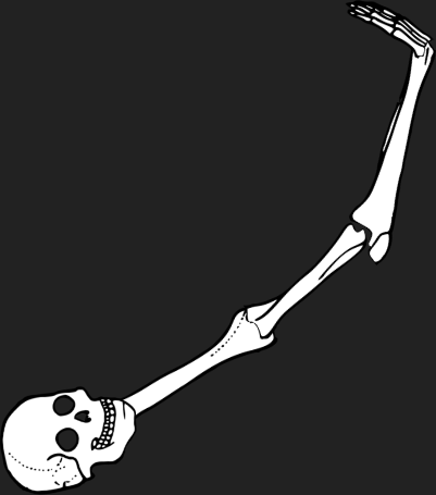 Dem bones dem bones dem – dry bones!