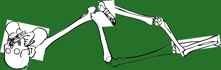 Dem bones dem bones dem – dry bones!