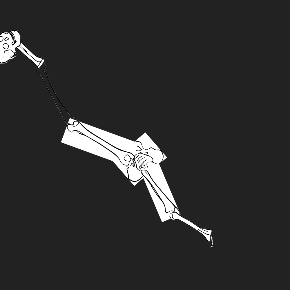 Dem bones dem bones dem – dry bones!